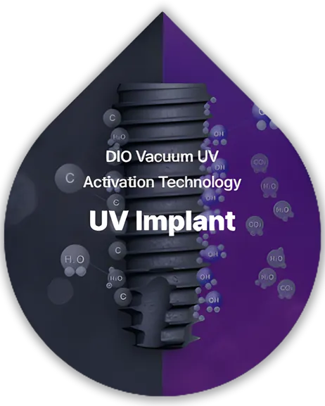 DIO Dental Implant Procedure