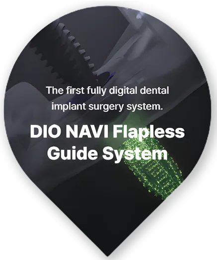 DIO Implant Innovation India