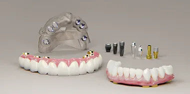 DIOnavi surgical guide used during implant placement